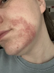 Review image 1